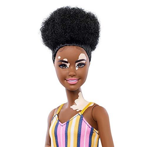 Barbie Fashionistas Doll with Vitiligo and Curly Brunette Hair Wearing Striped Dress and Accessories #135 - sctoyswholesale